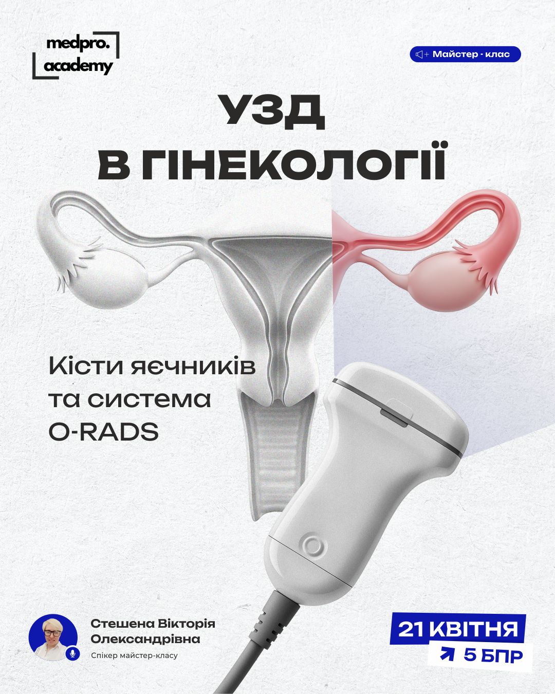 3УЗД в гінекології кісти яєчників та система O-RADS